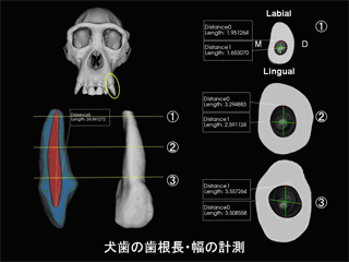 chimp_toothCT